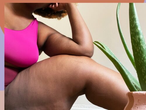 Why Some Ladies' Inner Thighs Are Dark And Ways You Can Lighten Them
